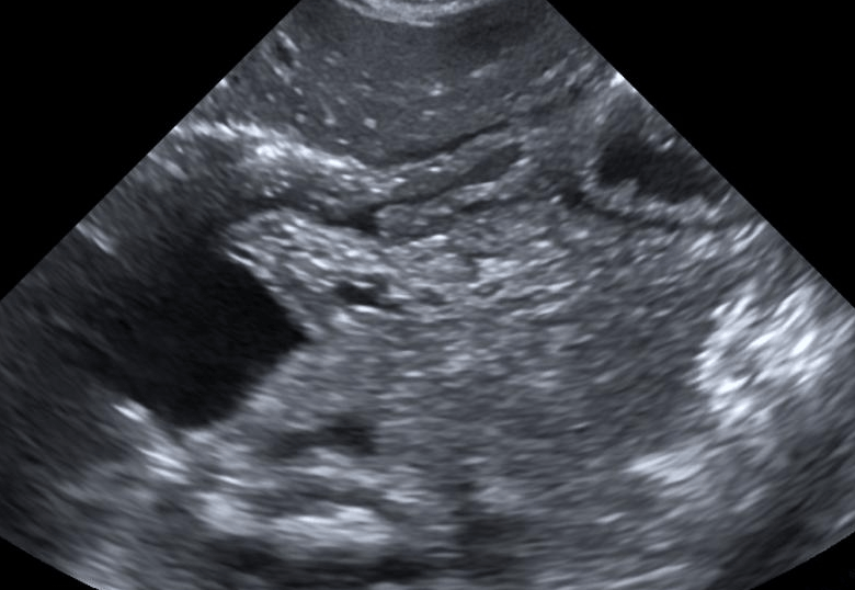 DeepSight Technology Secures  mln In Series A Funding to Reinvent Diagnostic Imaging
