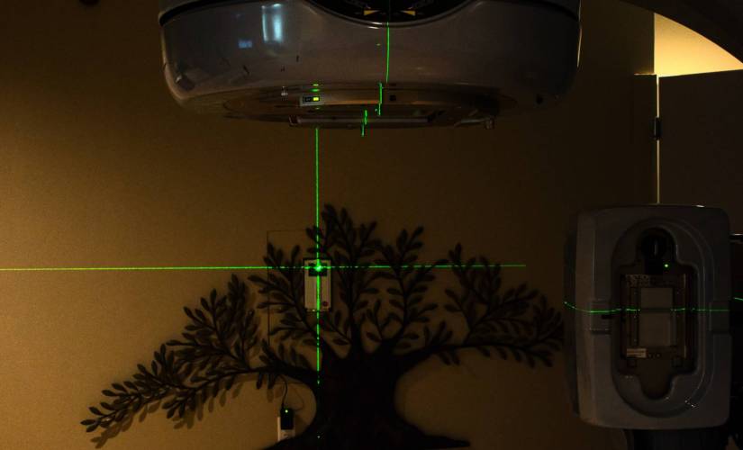 AI reduces cancer radiotherapy treatment time AI reduces cancer radiotherapy treatment time