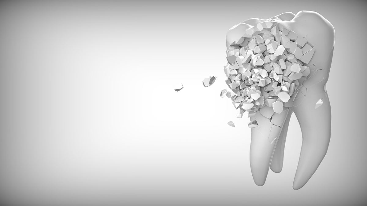 A Comparison Between Zirconia Teeth vs Lumineers